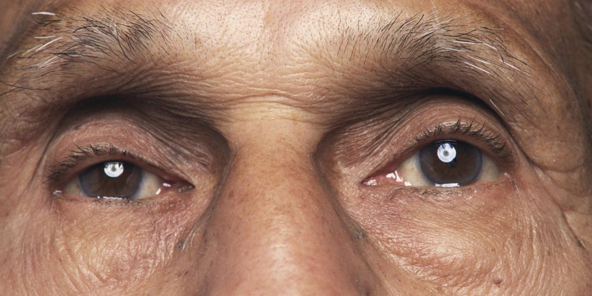 O bacterie oculară asociată cu boala Alzheimer, conform unui nou studiu Prezența bacteriei Chlamydia pneumoniae în retină este legată de declinul cognitiv și de boala Alzheimer, conform unei cercetări realizate de experți de la Cedars-Sinai Medical Center din Statele Unite