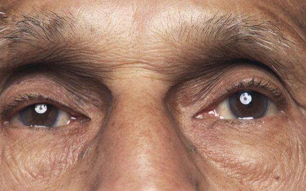 O bacterie oculară asociată cu boala Alzheimer, conform unui nou studiu Prezența bacteriei Chlamydia pneumoniae în retină este legată de declinul cognitiv și de boala Alzheimer, conform unei cercetări realizate de experți de la Cedars-Sinai Medical Center din Statele Unite