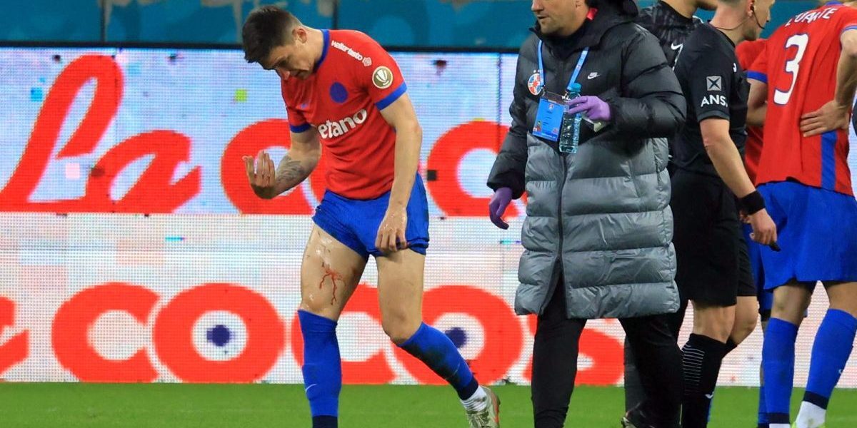 Accidentare gravă la nivelul extremităților, impact major