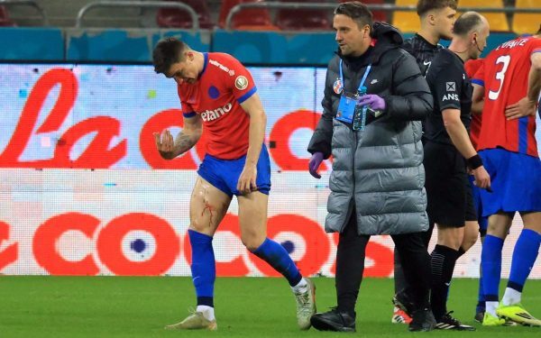 Accidentare gravă la nivelul extremităților, impact major