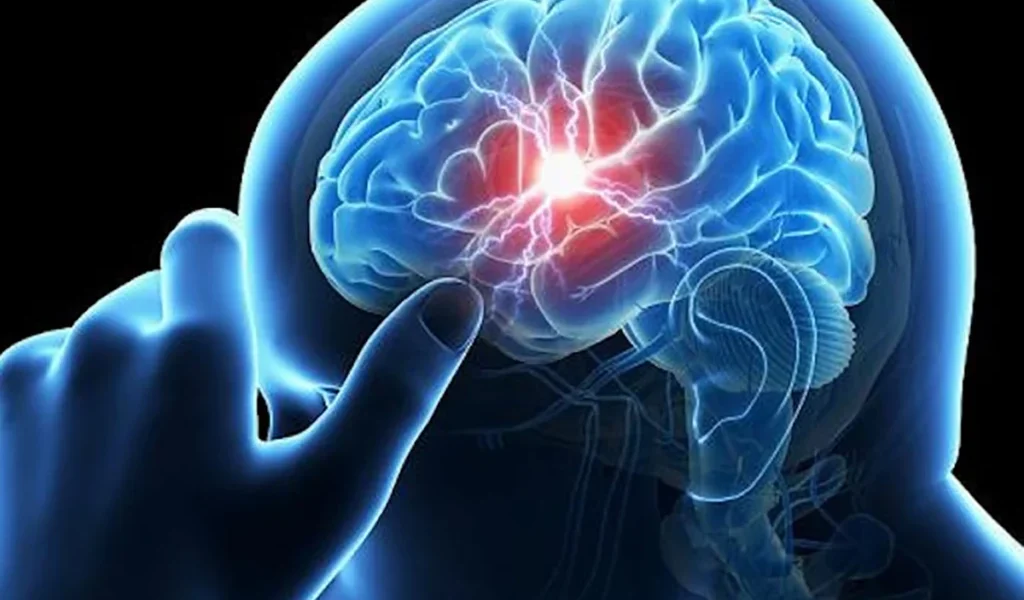 Accidentul vascular cerebral poate lovi oricând, chiar și la vârsta celor mai tineri: Semnale de alarmă și perspective de tratament Un eveniment cerebral de o severitate extremă, accidentul vascular cerebral (AVC) poate apărea la orice vârstă, inclusiv în rândul adulților tineri, și reprezintă una dintre principalele cauze de dizabilitate și mortalitate la nivel mondial