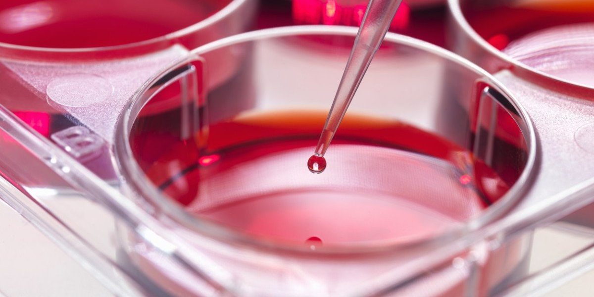 O descoperire revoluționară în medicină ar putea transforma modul în care tratăm leucemia mieloidă acută, una dintre cele mai agresive forme de cancer hematologic