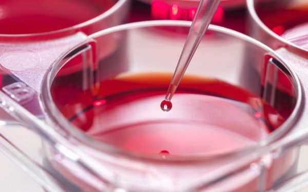 O descoperire revoluționară în medicină ar putea transforma modul în care tratăm leucemia mieloidă acută, una dintre cele mai agresive forme de cancer hematologic