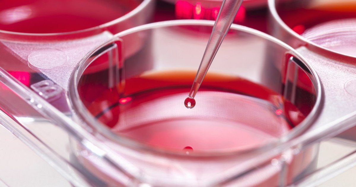 O descoperire revoluționară în medicină ar putea transforma modul în care tratăm leucemia mieloidă acută, una dintre cele mai agresive forme de cancer hematologic