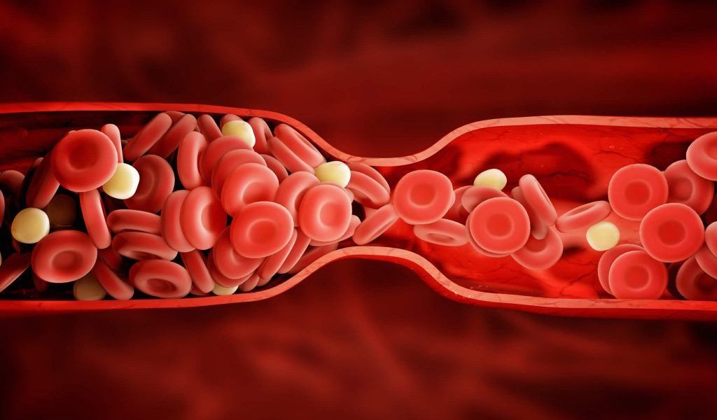 Vitamina K, esențială pentru sănătate, poate deveni un risc dacă este administrată fără supraveghere medicală Vitamina K este adesea considerată o aliată a sănătății, fiind responsabilă pentru procesul natural de coagulare a sângelui și pentru prevenirea sângerărilor spontane sau excesive
