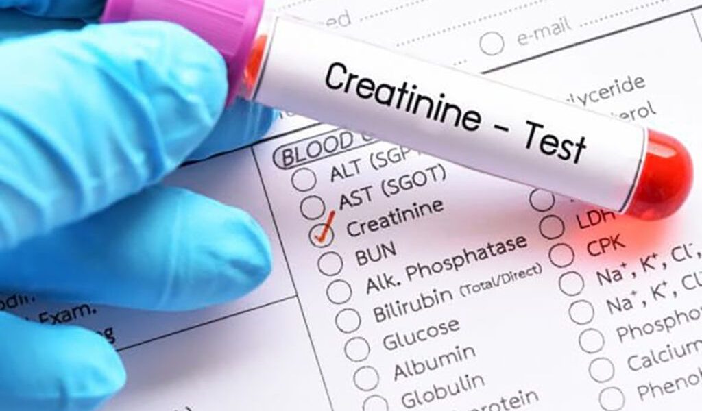 Importanța analizei de sânge pentru sănătatea rinichilor: Creatinina, indicatorul esențial În lumea medicală, anumite analize de sânge sunt considerate cheie pentru diagnosticarea și monitorizarea bolilor cronice, iar creatinina ocupă un loc deosebit în acest peisaj
