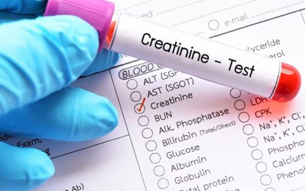 Importanța analizei de sânge pentru sănătatea rinichilor: Creatinina, indicatorul esențial În lumea medicală, anumite analize de sânge sunt considerate cheie pentru diagnosticarea și monitorizarea bolilor cronice, iar creatinina ocupă un loc deosebit în acest peisaj