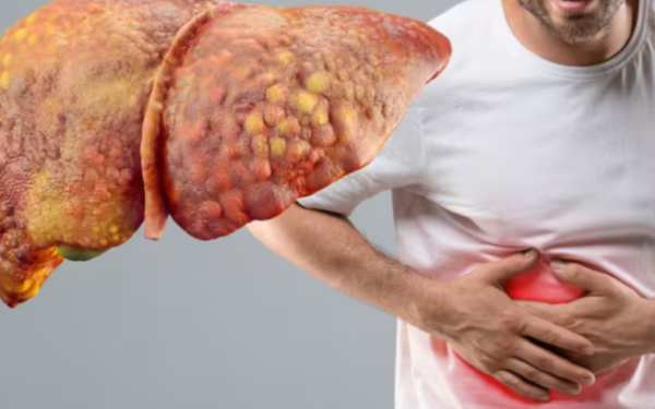 Ficatul, un organ vital al corpului uman, află sub o atenție tot mai mare din cauza stilului de viață modern și a factorilor care îl afectează