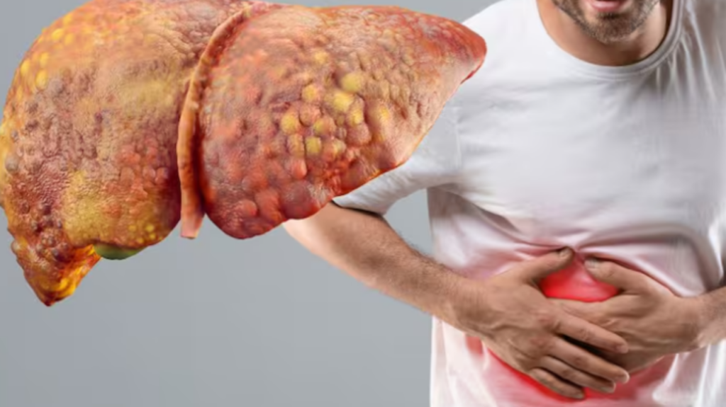 Ficatul, un organ vital al corpului uman, află sub o atenție tot mai mare din cauza stilului de viață modern și a factorilor care îl afectează