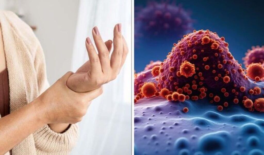 Cele 10 semne timpurii ale cancerului pe care nu trebuie să le ignori Detectarea cancerului în stadiu incipient face diferența între o șansă reală de vindecare și evoluția spre complicații grave