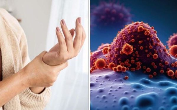 Cele 10 semne timpurii ale cancerului pe care nu trebuie să le ignori Detectarea cancerului în stadiu incipient face diferența între o șansă reală de vindecare și evoluția spre complicații grave