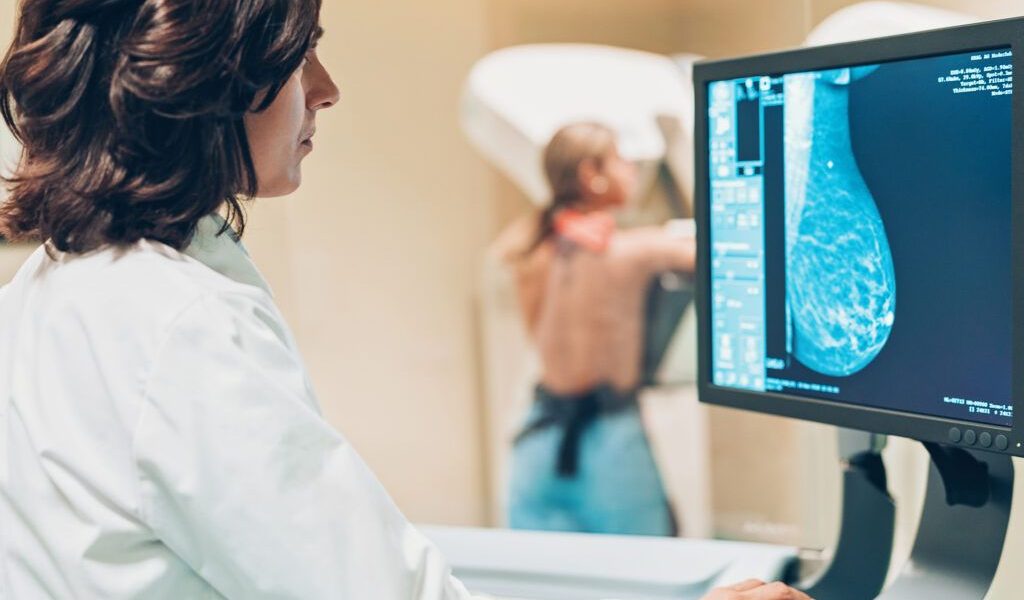 România înfruntă o realitate dureroasă: anual, peste 12.000 de femei primesc diagnosticul de cancer de sân, o boală care afectează tot mai mult femeile din țară