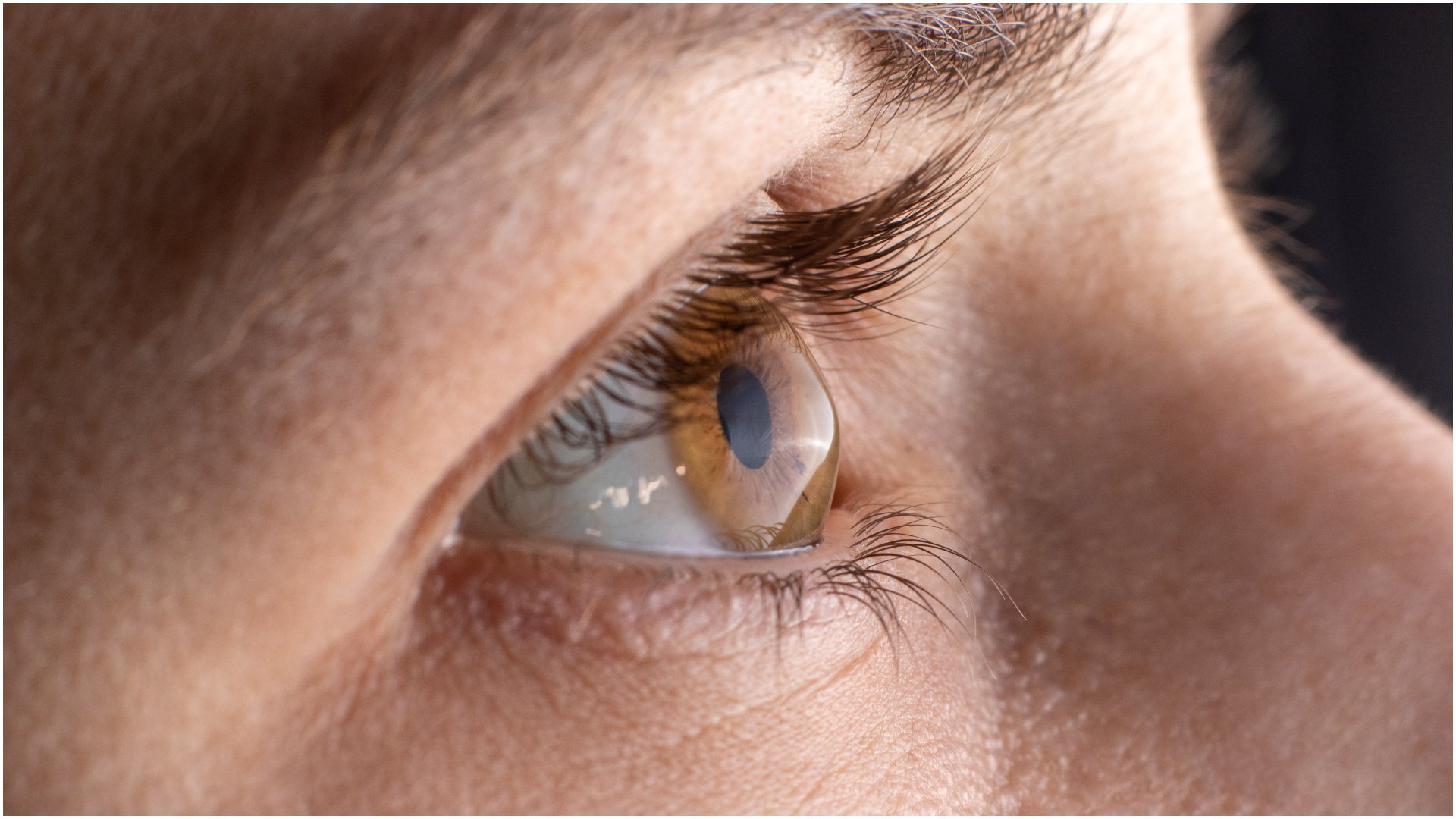 O descoperire revoluționară în domeniul medicinii oftalmologice: corneea artificială realizată din solzi de pește poate schimba viața pacienților cu probleme oculare grave Tratamentul afecțiunilor severe ale corneei, stratul transparent și esențial pentru vedere, a primit un impuls semnificativ odată cu anunțul cercetătorilor din Spania, care au dezvoltat o cornee artificială din solzi de pește