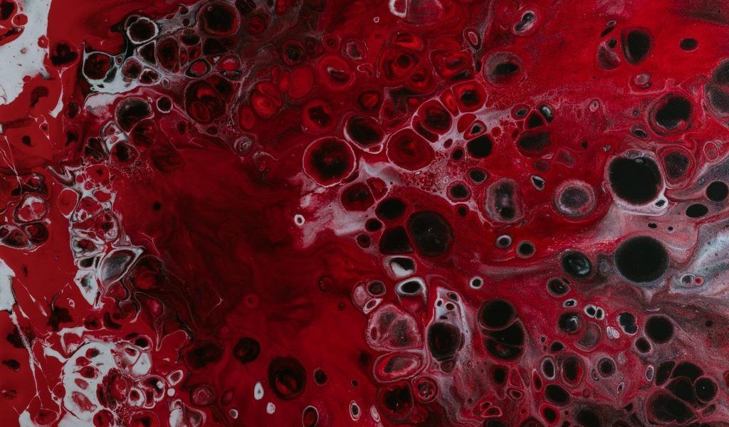 Anemia feriprivă, cea mai frecventă formă de anemie la nivel global, reprezintă o problemă de sănătate adesea subestimată, dar cu consecințe serioase asupra organismului