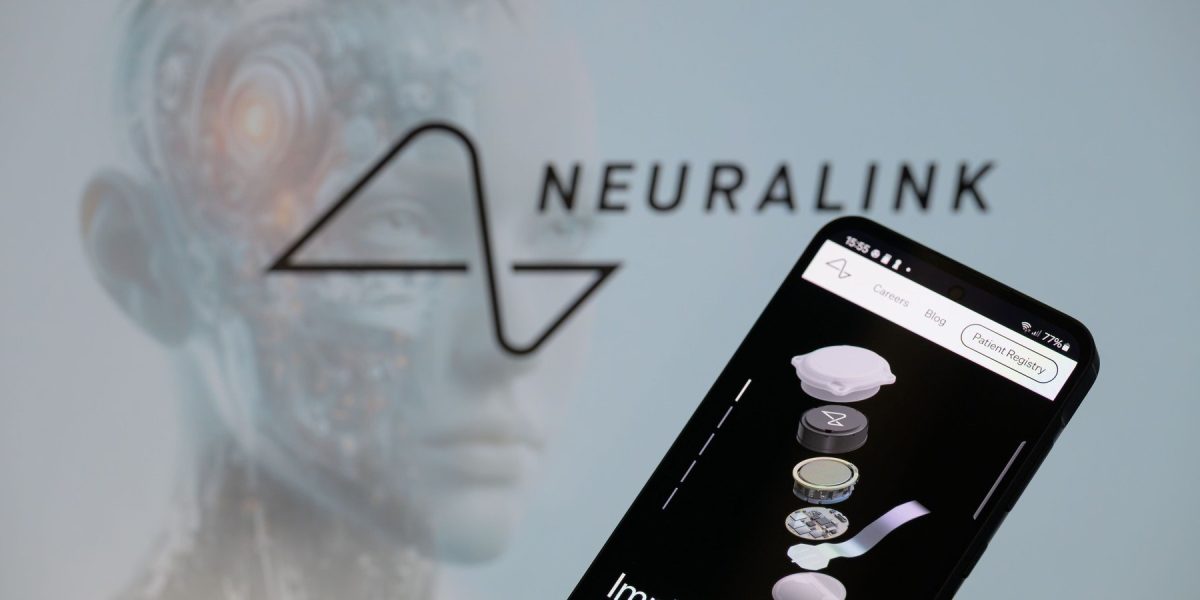 China avansează decisiv în domeniul inteligenței artificiale și al tehnologiilor neurochirurgicale, după ce autoritatea națională de reglementare a aprobat recent primul produs de interfață creier-computer destinată implanturilor cerebrale