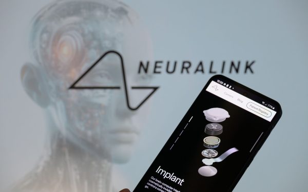 China avansează decisiv în domeniul inteligenței artificiale și al tehnologiilor neurochirurgicale, după ce autoritatea națională de reglementare a aprobat recent primul produs de interfață creier-computer destinată implanturilor cerebrale
