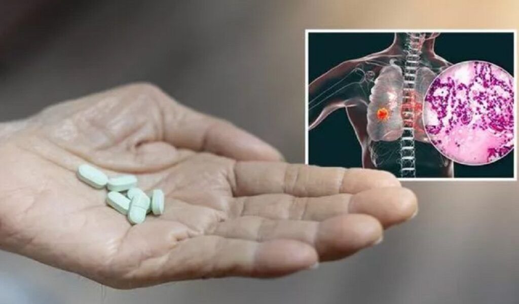 Consumul de suplimente alimentare: un obicei tot mai răspândit, dar cu riscuri ascunse În ultimele decenii, interesul pentru menținerea sănătății a crescut exponential, iar suplimentele alimentare au devenit parte integrantă din rutina zilnică a multor români
