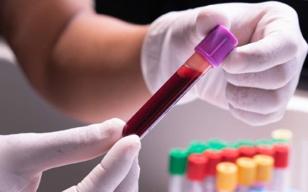 Un test de sânge inovator promite să revoluționeze modul în care medicii vor putea identifica riscul de demență la femei, chiar cu câțiva zeci de ani înainte ca simptomele să devină evidente