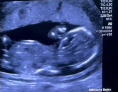 Gravidă, EXCLUSĂ de la Filantropia: Transferată în Germania pentru tratament MEDICAL! Ce s-a întâmplat