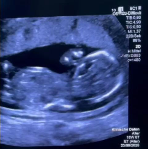 Gravidă, EXCLUSĂ de la Filantropia: Transferată în Germania pentru tratament MEDICAL! Ce s-a întâmplat