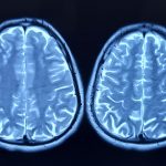 Oamenii de știință dezvăluie secretul îmbătrânirii creierului