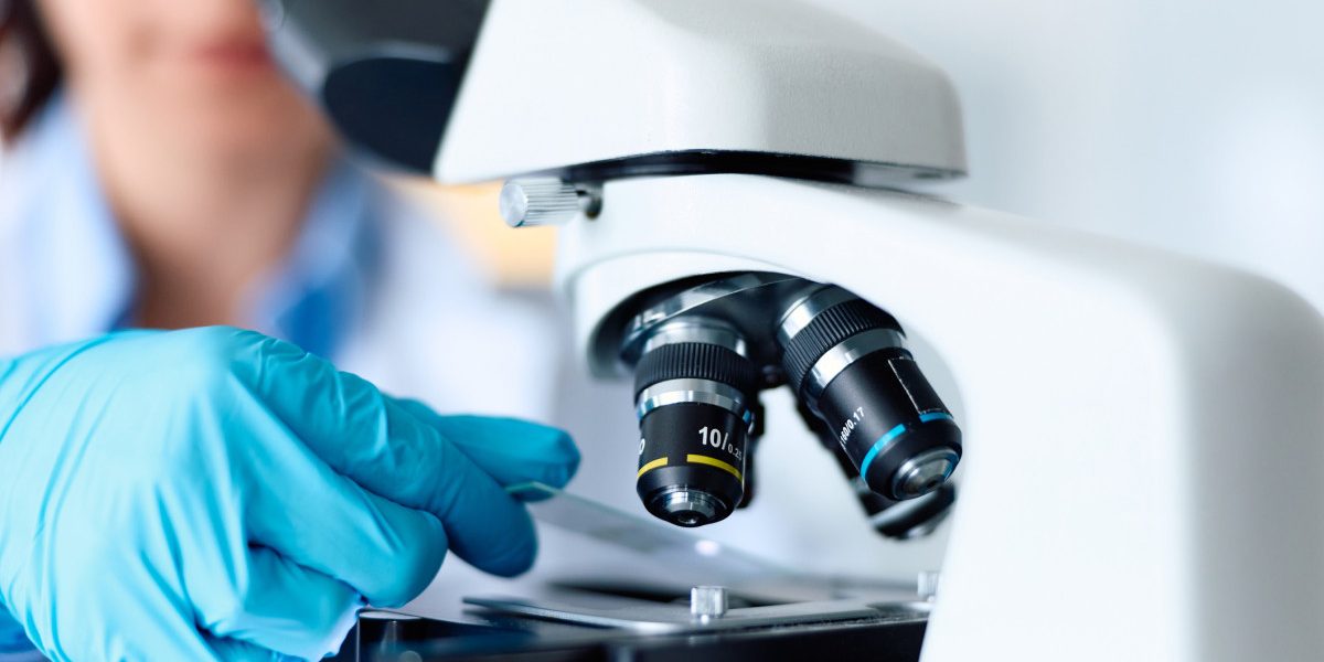 Nouă descoperire în lupta cu Parkinson: Speranțe în celulele nervoase