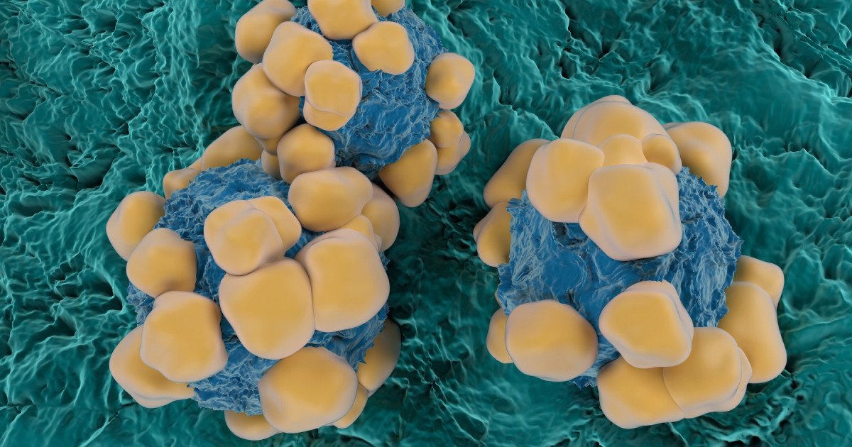 Oameni de știință, REVOLUȚIE: Senzori minusculi detectează cancerul rapid!