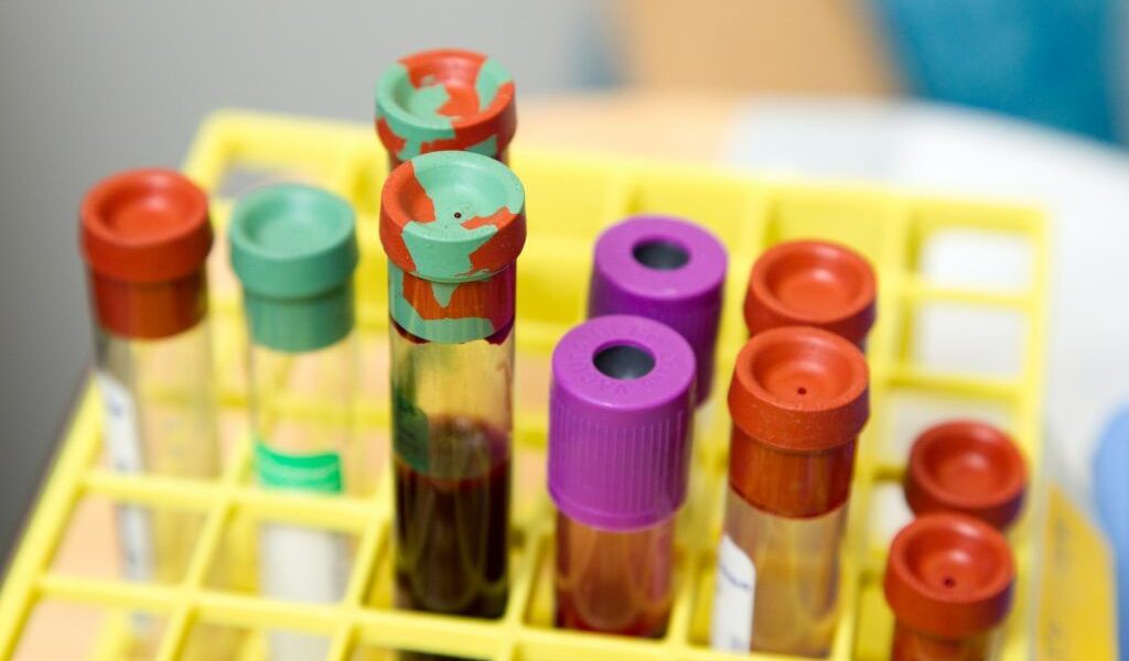 Cât costă analizele în 2026 pentru românii fără asigurare Medicală