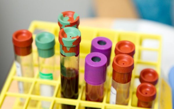 Cât costă analizele în 2026 pentru românii fără asigurare Medicală