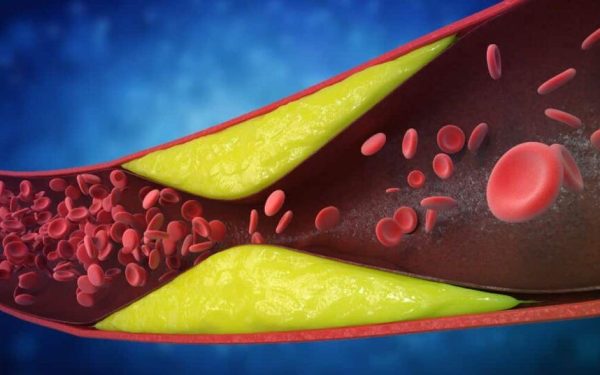 Șapte semne de ATHERO-SCELEROZĂ ignorate: Atenție la ce simțiți!