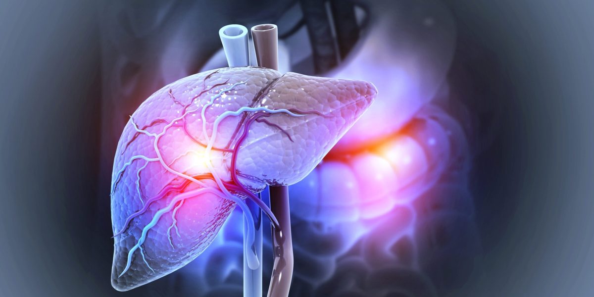 Boala ficatului gras, explozie mondială: 1,8 miliarde de oameni, în pericol