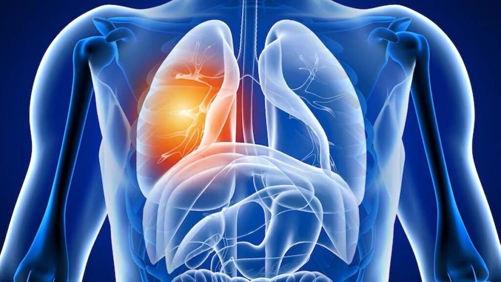 Avertisment după COVID-19: Ce efecte are virusul asupra plămânilor