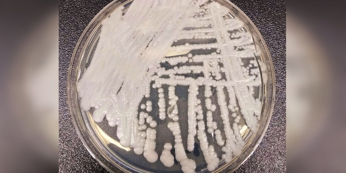 Candida auris, coșmarul spitalelor, endemică și în România