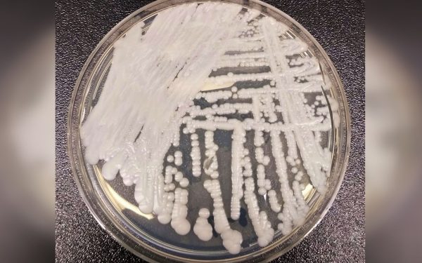 Candida auris, coșmarul spitalelor, endemică și în România