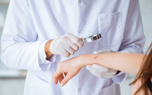 Ectimă: De ce apare infecția cutanată și cum o combați