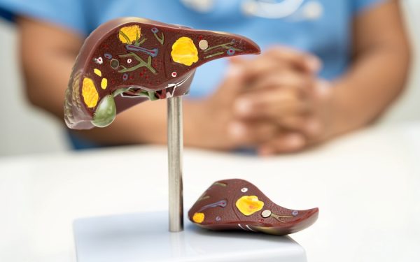 Boala tăcută ce-i lovește pe tineri: Stilul de viață modern, un pericol ascuns