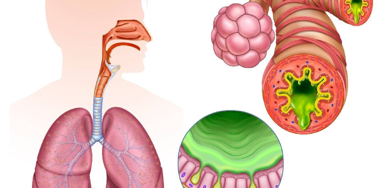 Inflamația cronică, „dușmanul invizibil”: Cum ne afectează sănătatea