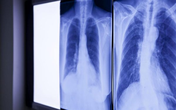 Bărbat, operat de urgență: Medicii au rămas șocați de ce au găsit în abdomen
