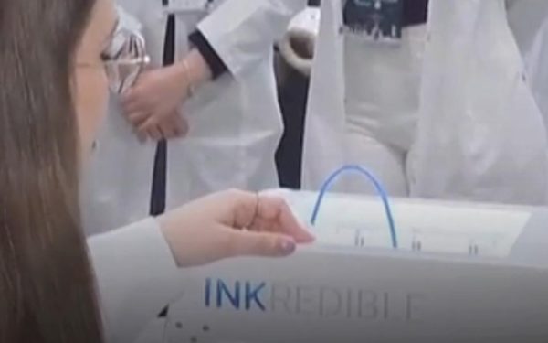 Rinichi „printat” în România: Cercetătorii uimesc cu medicina 3D!