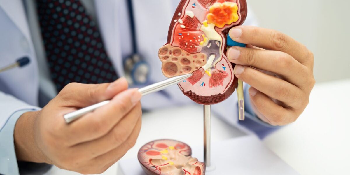 Acid uric vs. creatinină: ce secrete ascund analizele renale?