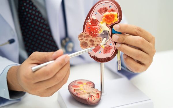 Acid uric vs. creatinină: ce secrete ascund analizele renale?