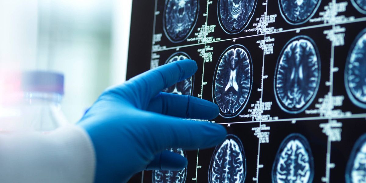 Oamenii devin mai puțin inteligenți? Marea îngrijorare a cercetătorilor