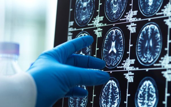 Oamenii devin mai puțin inteligenți? Marea îngrijorare a cercetătorilor