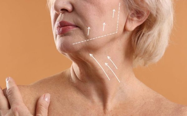 Gâtul are nevoie de bisturiu: când liftingul cervical nu mai e tratament estetic