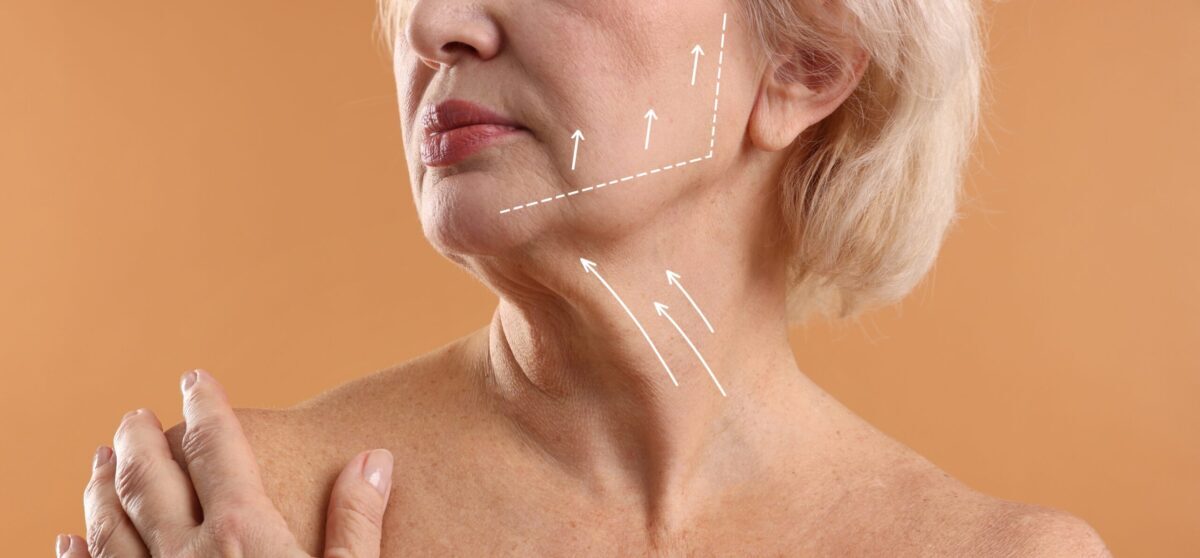 Gâtul are nevoie de bisturiu: când liftingul cervical nu mai e tratament estetic
