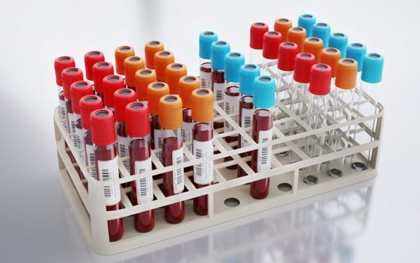 Analize Sânge Esențiale: Ce Detectivează Medicii