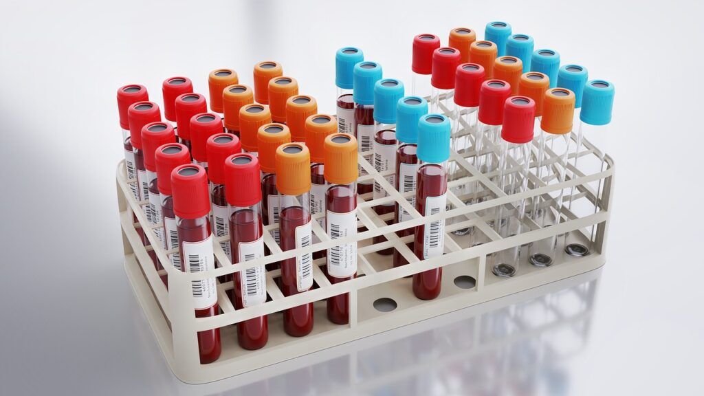 Analize Sânge Esențiale: Ce Detectivează Medicii