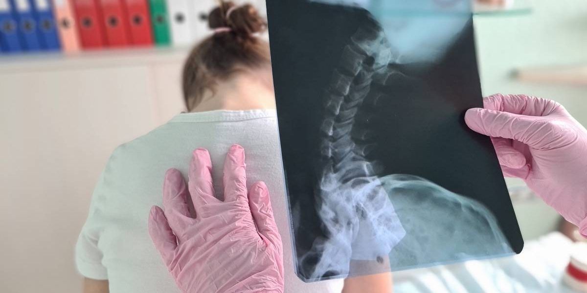 Copiii stau cocoșați: Osteopat explică cauza reală, nu doar telefonul